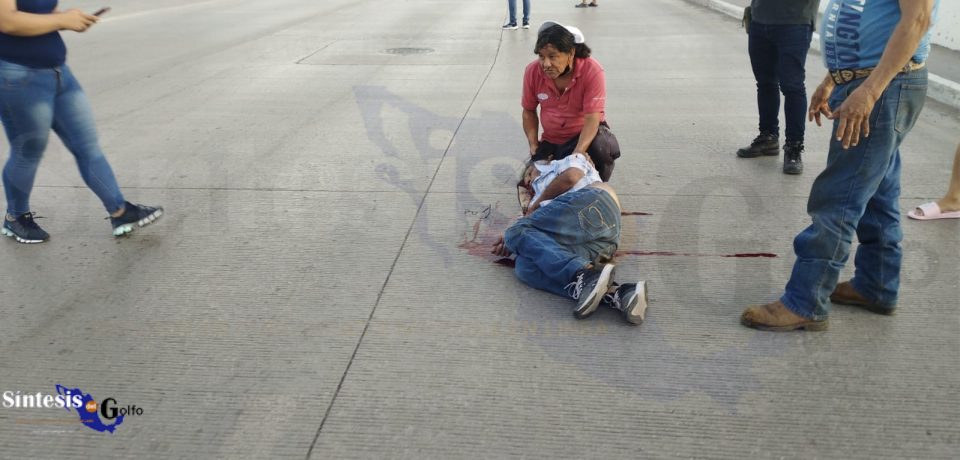 Adulto mayor atropellado por raudo automóvil en la avenida Monterrey 